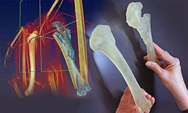 左邊是雄鷹健康的肱骨，右邊是雄鷹實際受傷的骨頭的復制品