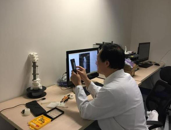 3D打印醫(yī)療應(yīng)用成功案例 北醫(yī)三院3D打印定制人工椎體植入術(shù)