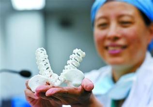 世界首例醫療3D打印應用案例 3D打印假體骶椎成功植入
