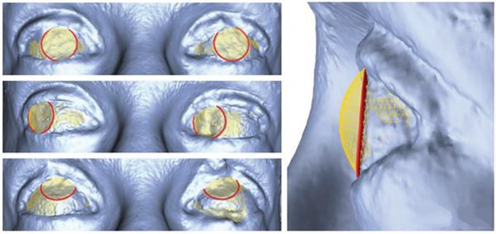 3D打印新技術 迪斯尼用照片重建繪制3D眼部立體圖_e鍵3D打印服務