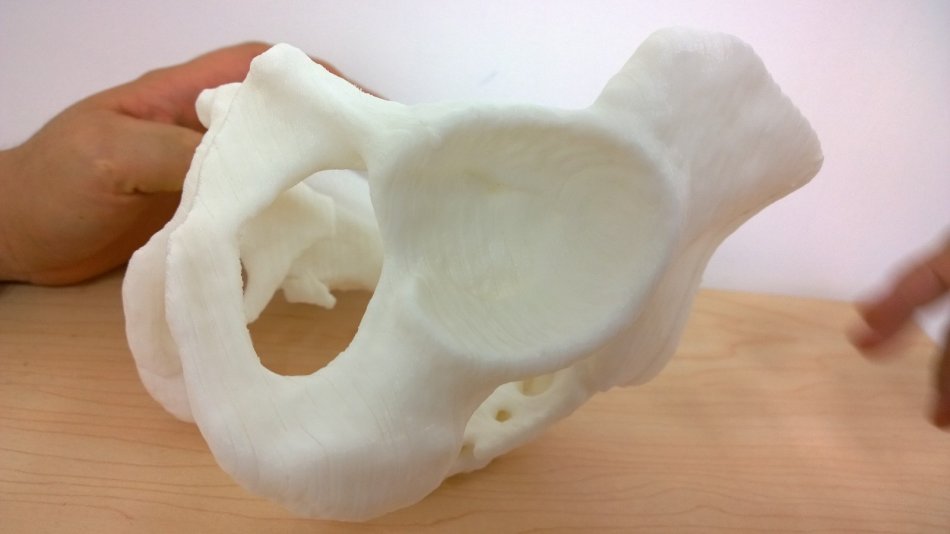 3d打印應用領域之醫(yī)療應用_e鍵打印服務公司 3d打印應用領域之醫(yī)療應用_e鍵打印服務公司