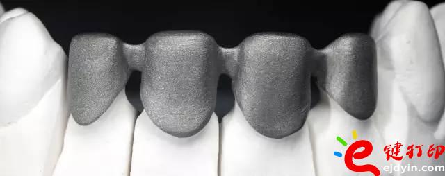 醫(yī)療輔助器械的變革之路 3d打印義齒(假牙)前景無(wú)限 勢(shì)在必行_醫(yī)療設(shè)備器械3d模型打印平臺(tái)